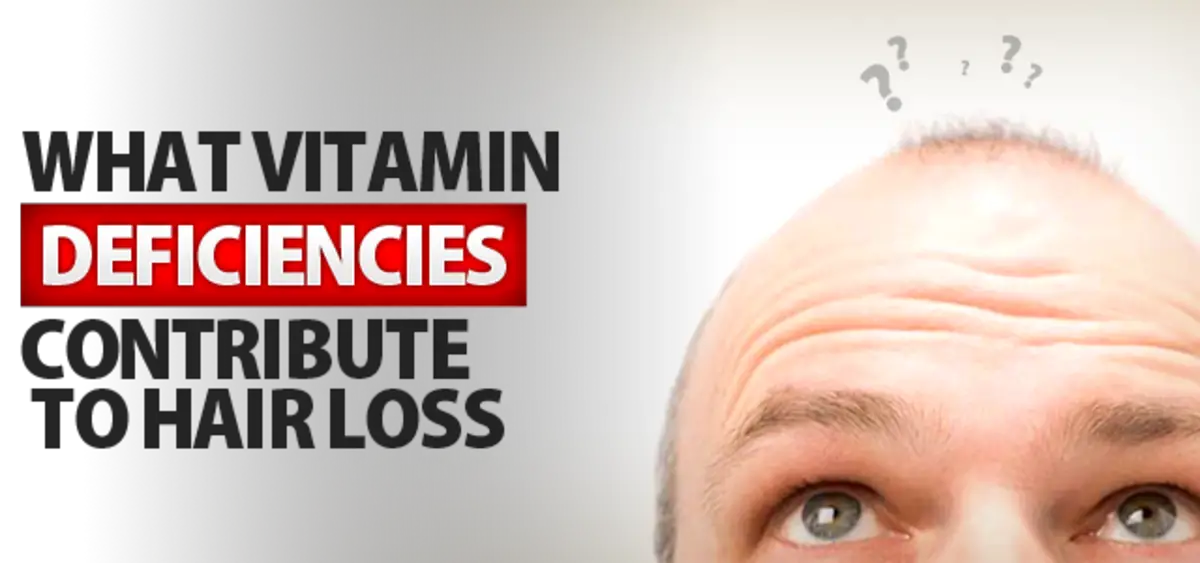 16 Vitamin Deficiencies that Lead to Hair Loss