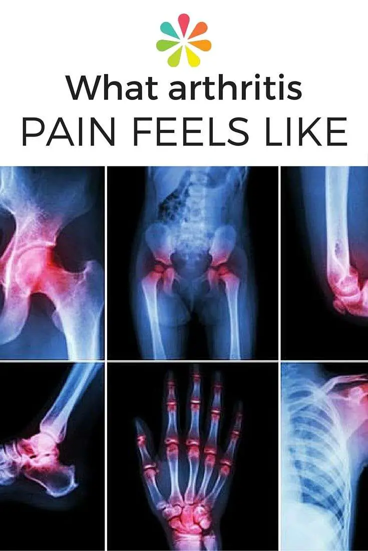 17 Best images about Hip &  Back Pain on Pinterest
