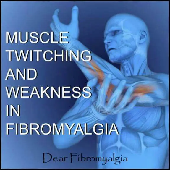 391 best Fibromyalgia &  other Autoimmune Diseases images on Pinterest ...