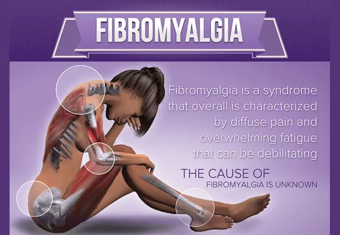 5 Early Symptoms of Fibromyalgia