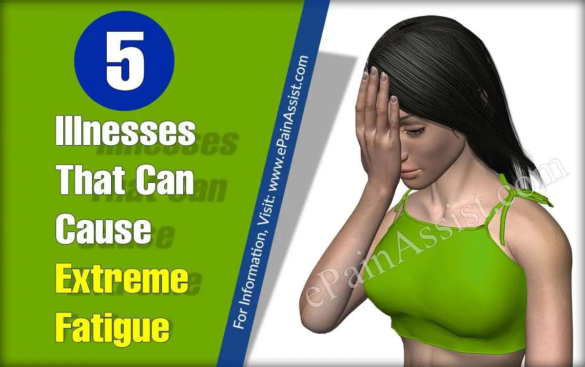 5 Illnesses That Can Cause Extreme Fatigue