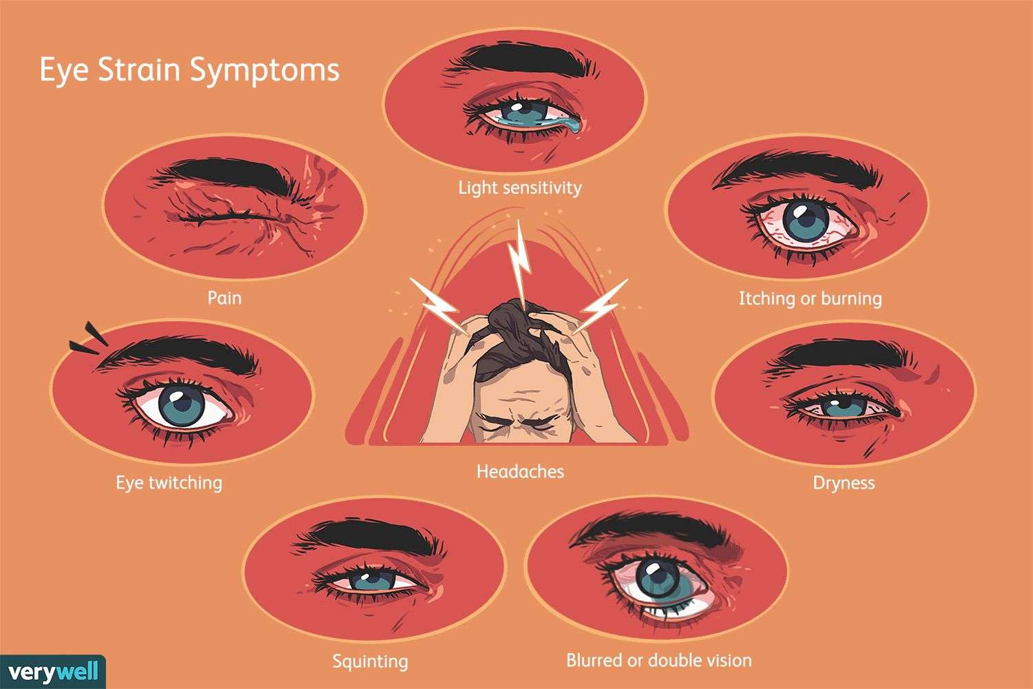 Asthenopia (Eye Strain): Symptoms, Causes, and Treatment