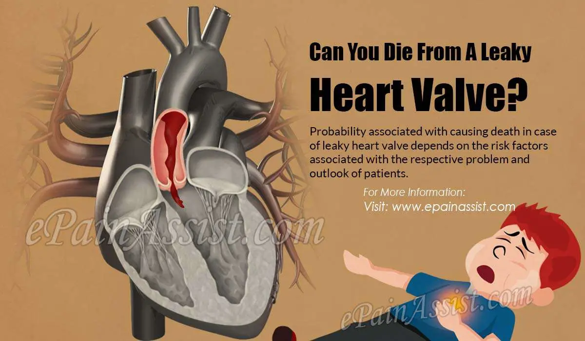 Can You Die From A Leaky Heart Valve?