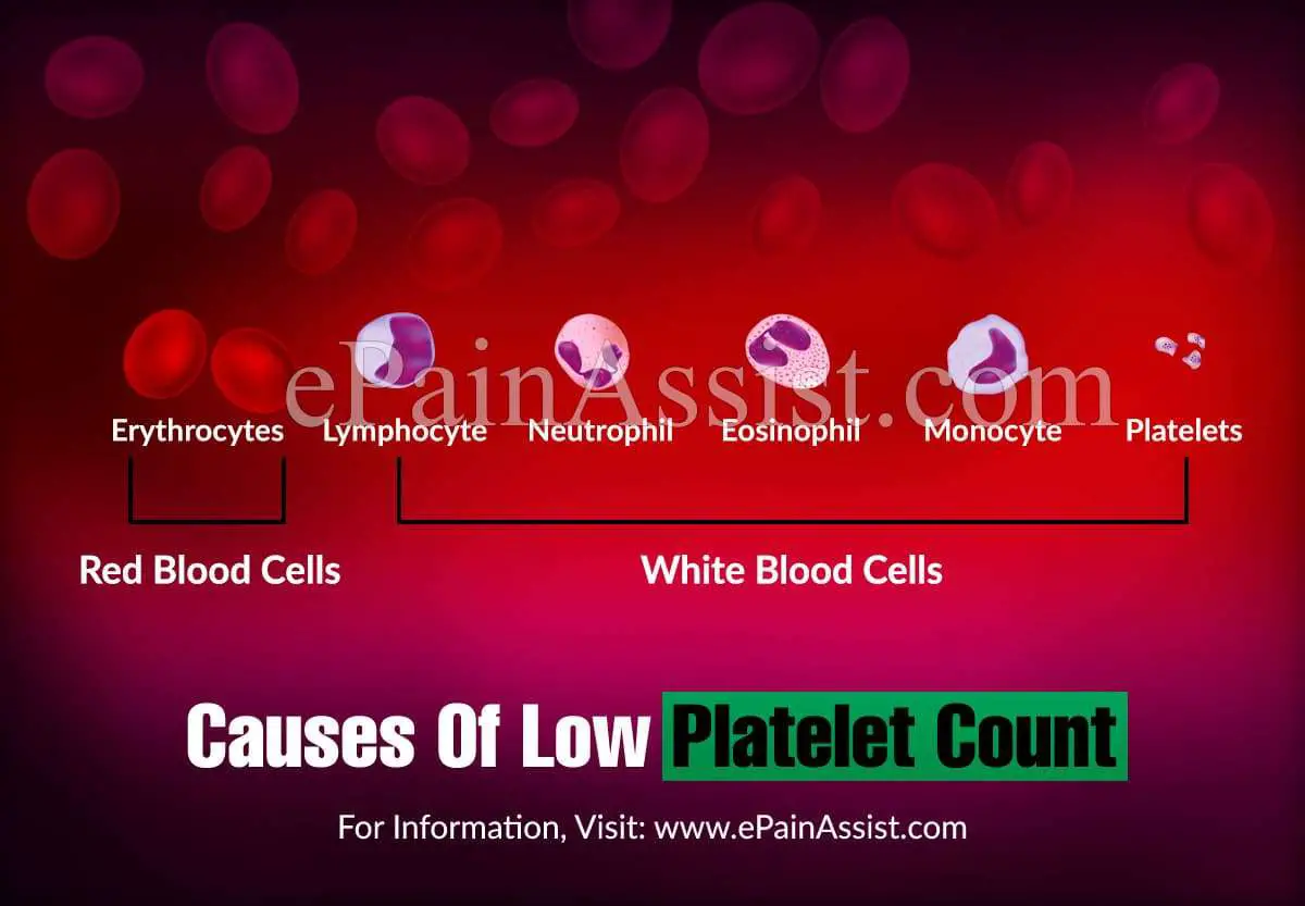 Causes Of Low Platelet Count or Thrombocytopenia, Its ...