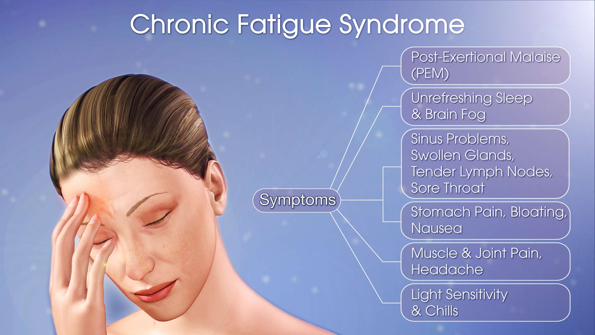 Chronic Fatigue Syndrome Shown &  Explained Using A Medical ...