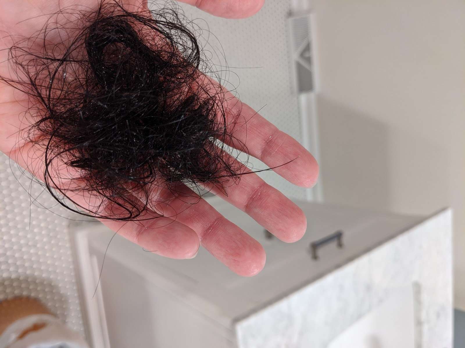 COVID Hair Loss: A Womans Experience Losing Her Hair ...
