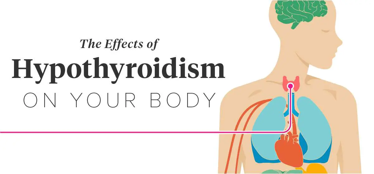 Effects of Hypothyroidism: Thinning Hair, Heart Attack and More