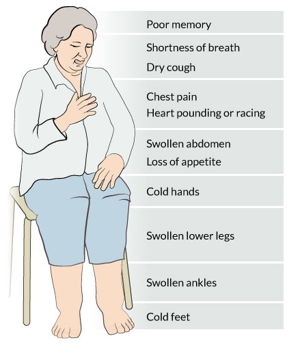 Fatigue Muscle Weakness And Shortness Of Breath Causes