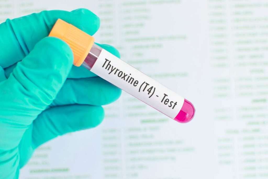 Frequently Asked Questions About Thyroxine And Thyroxine Test