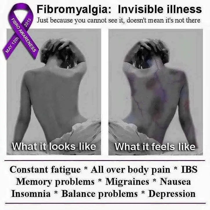 Getting diagnosed with fibromyalgia