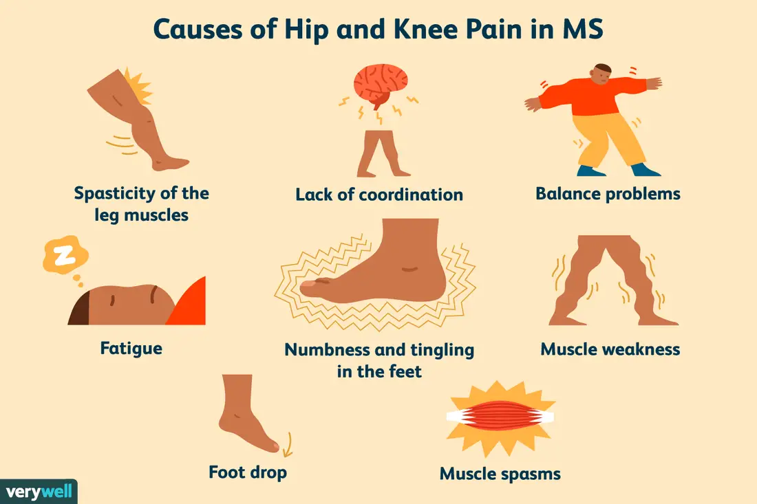 Hip and Knee Pain in Multiple Sclerosis
