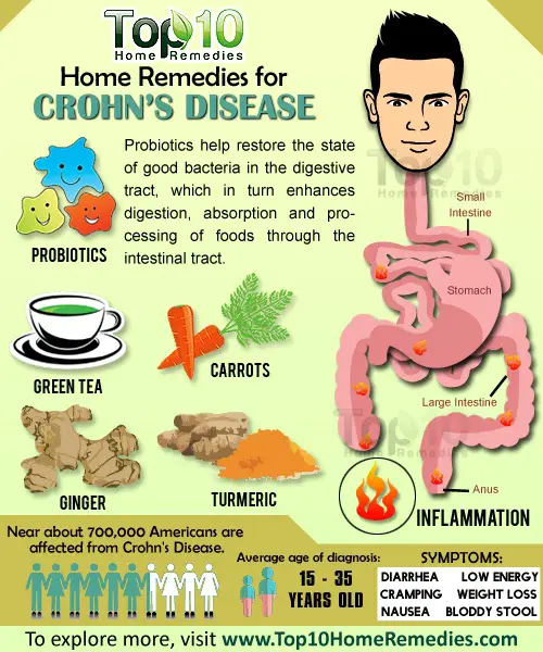 Home Remedies for Crohn