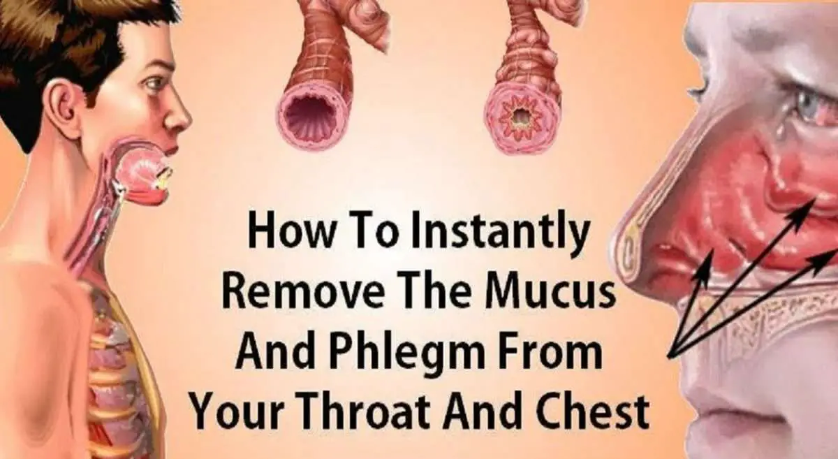 How to Eliminate Mucus and Phlegm from the Throat and Chest (Immediate ...