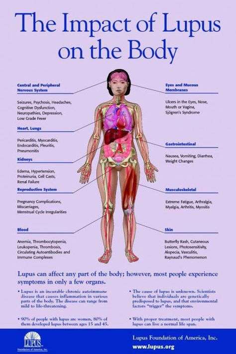 Infographic_Lupus_Symptoms