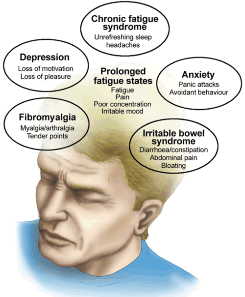 Is Chronic Fatigue Syndrome Treatable