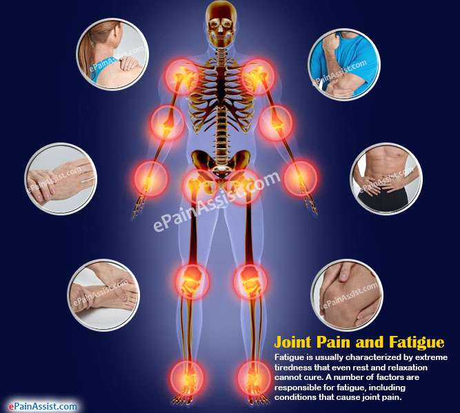 Joint Pain and Fatigue
