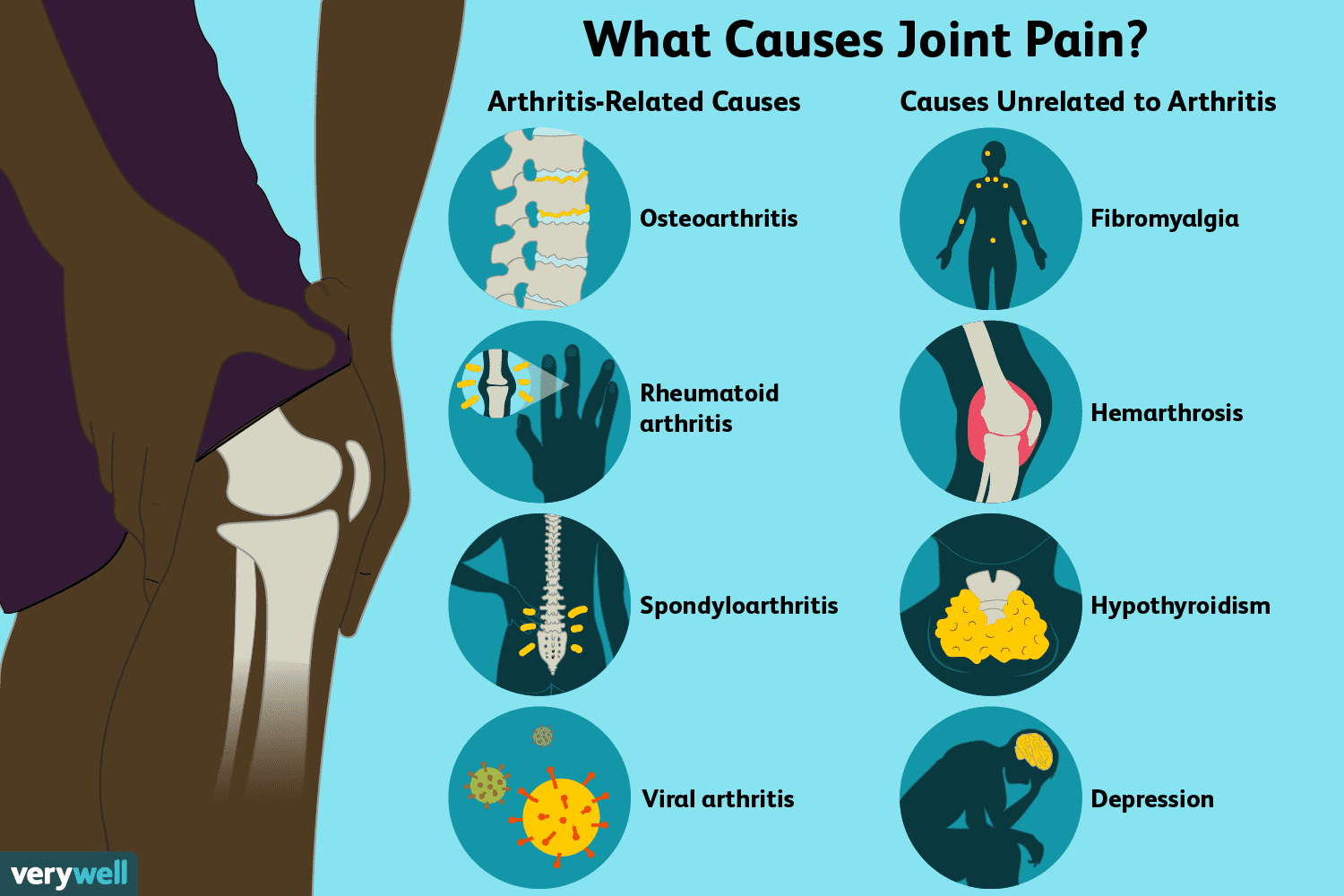 Joint Pain: Causes, Treatment, and When to See a Doctor