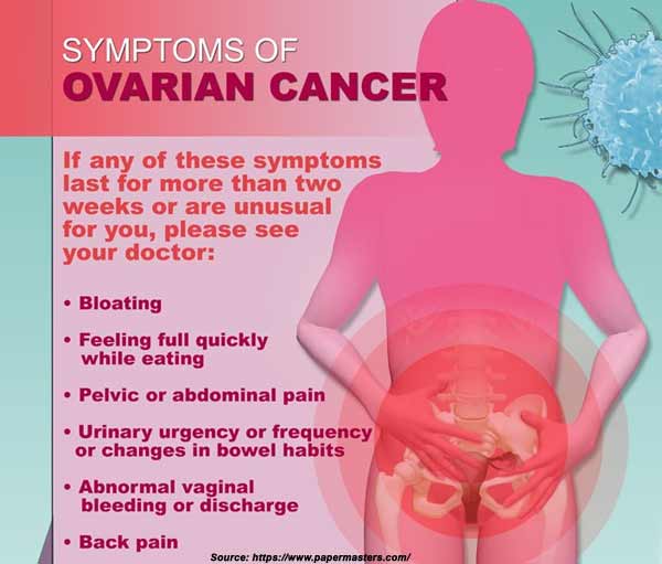 Lower back pain ovarian cancer  Gvdwk