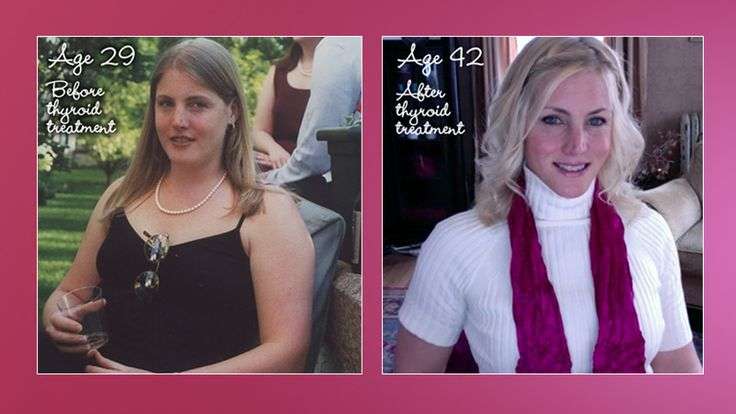 My Success Story with Hypothyroidism, Adrenal Fatigue, and Weight Loss ...