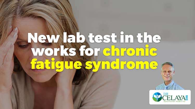 New lab test in the works for chronic fatigue syndrome ...