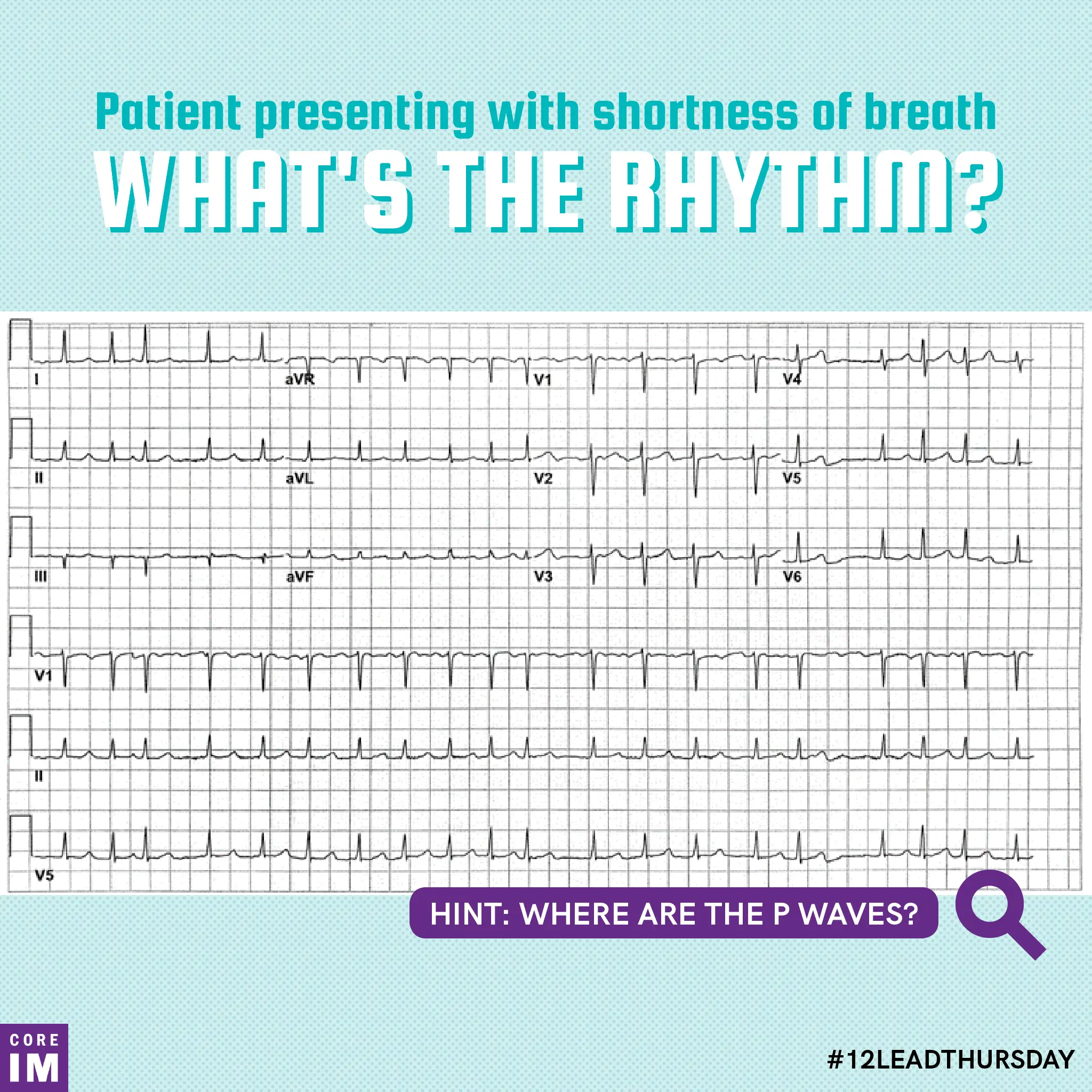 Patient presenting with shortness of breath...