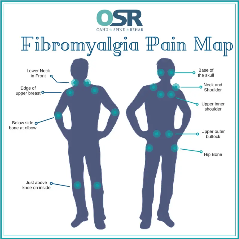 Physical Therapy for Fibromyalgia