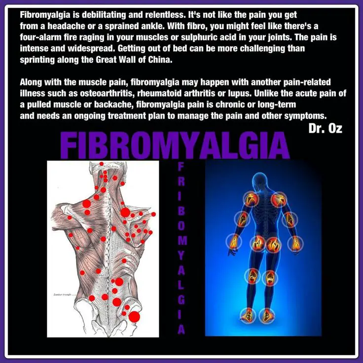 Pin on Fibromyalgia &  Migraines