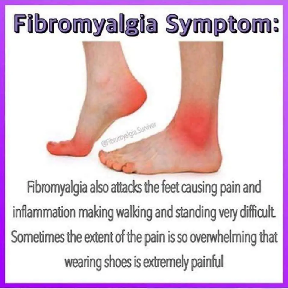 Pin on Fibromyalgia/Chronic Pain