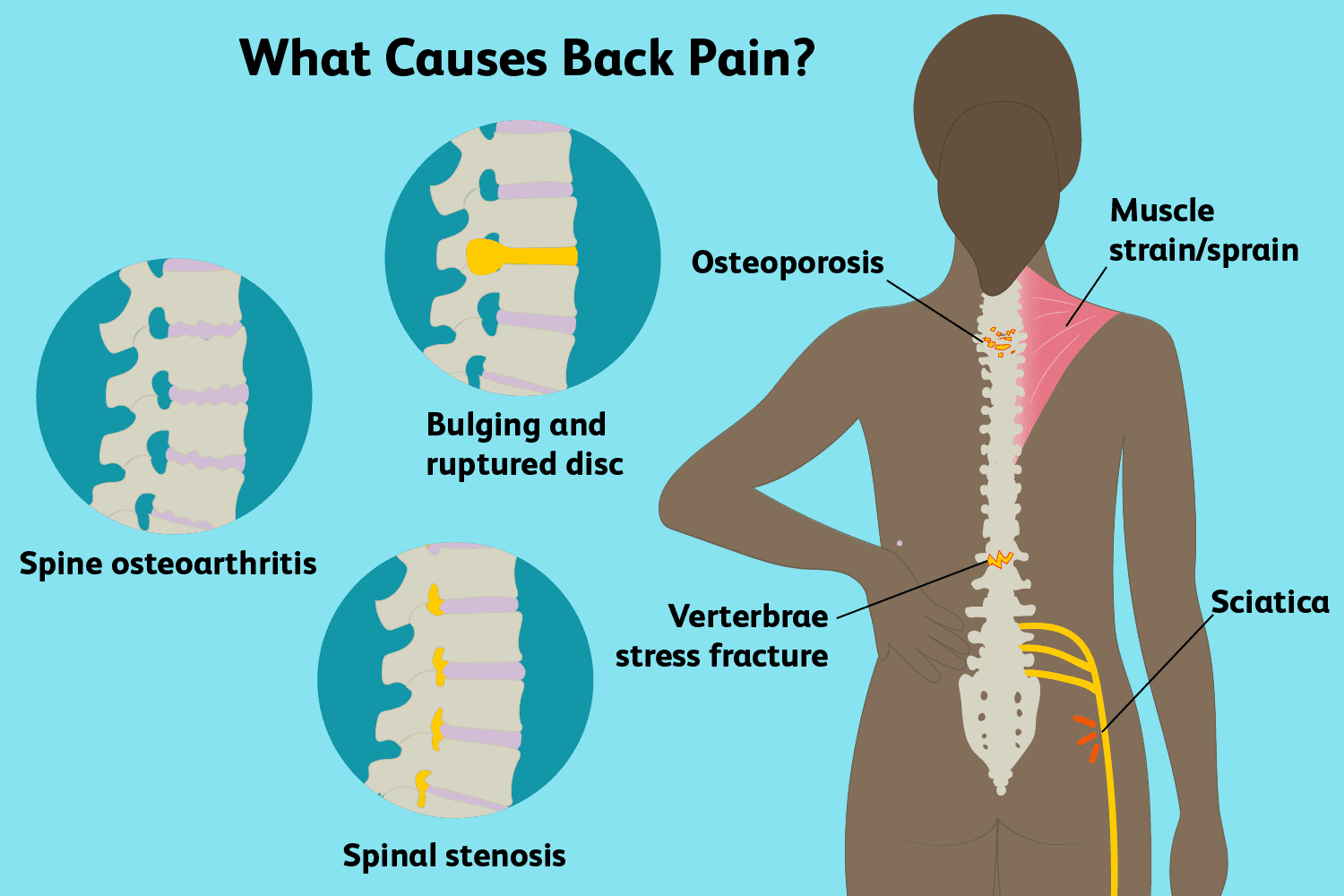 Pin on Neuro Spinal &  Back Pain Treatment Dubai