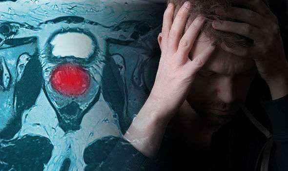 Prostate cancer symptoms: Signs the disease has advanced ...