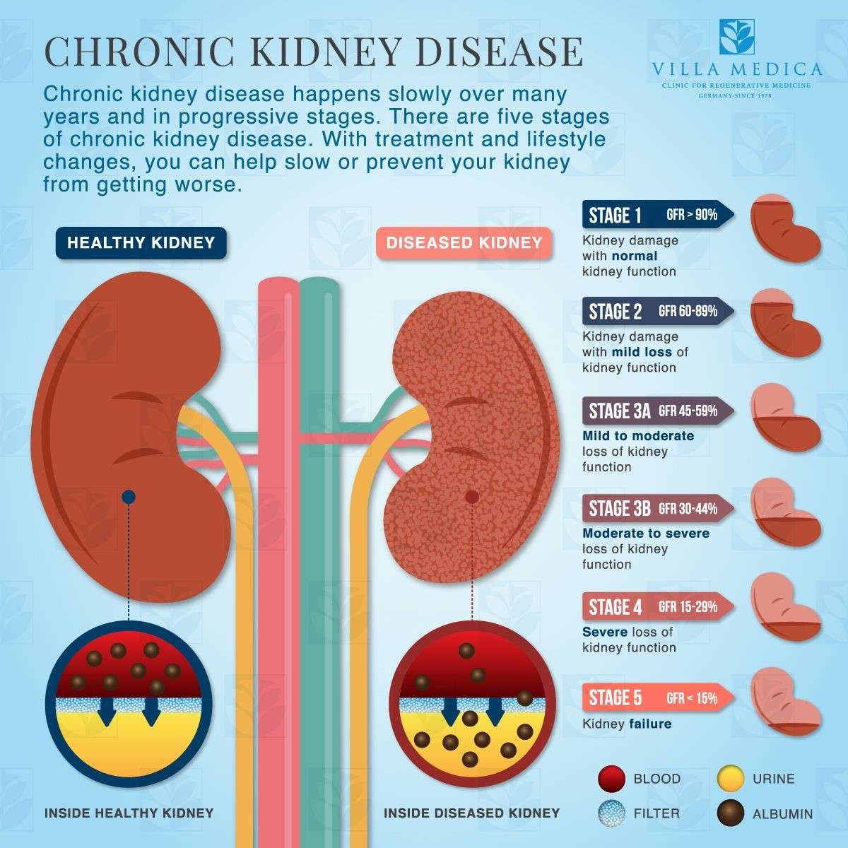 Reduced kidney function can improve with lifestyle ...