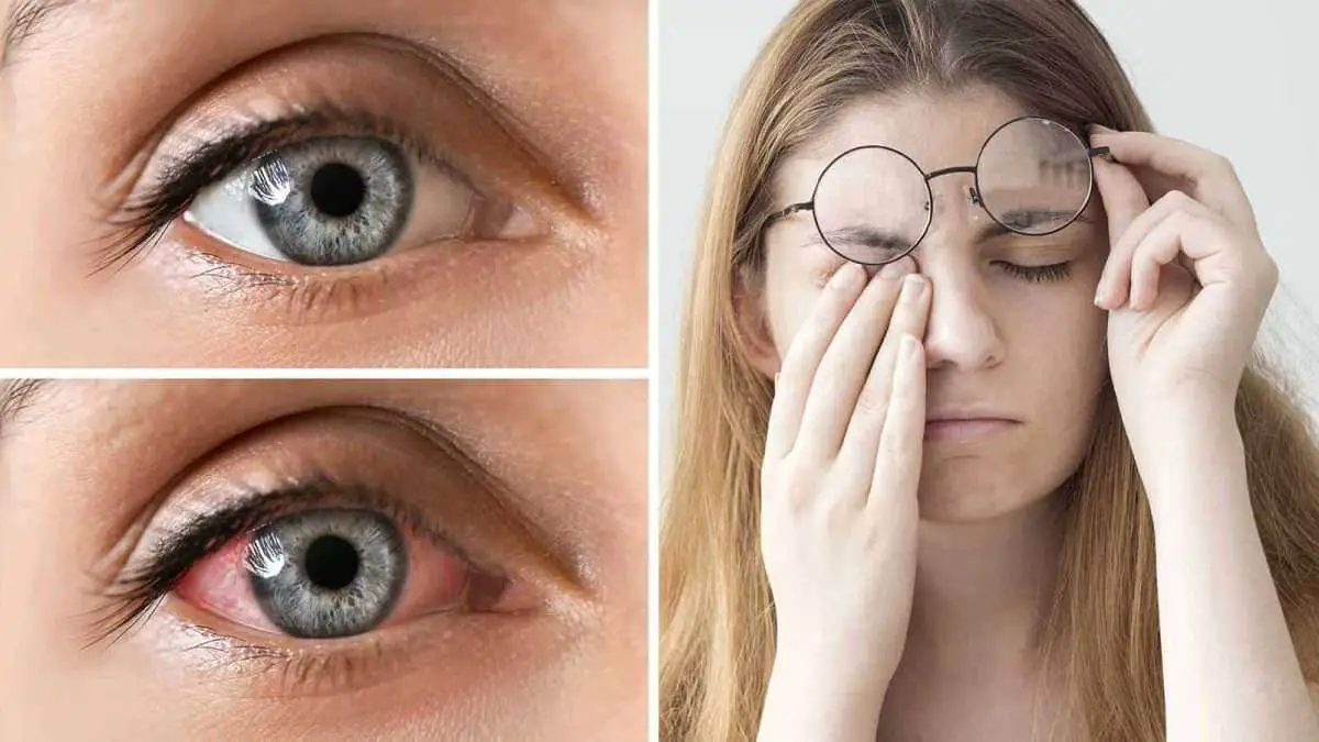 Science Reveals 15 Things That Help Reduce Eye Fatigue