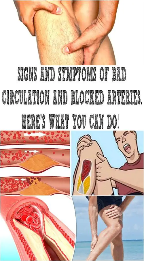 SIGNS AND SYMPTOMS OF BAD CIRCULATION AND BLOCKED ARTERIES. HERES WHAT ...