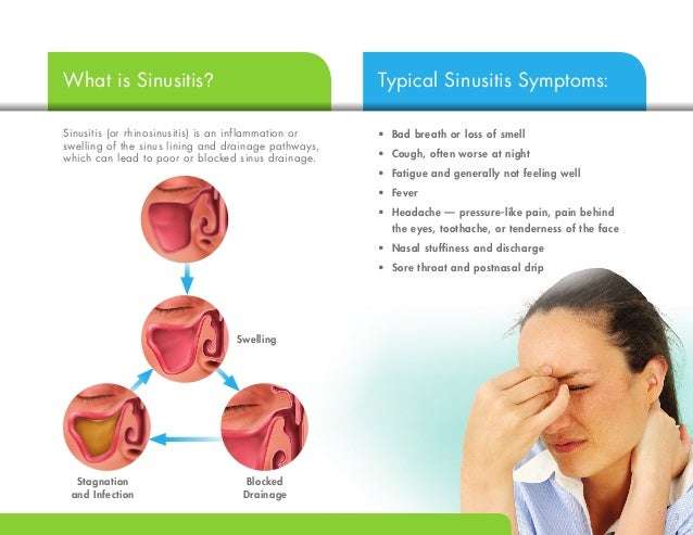 Sinus Treatment that Lasts