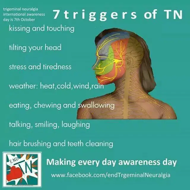 Some Trigeminal Neuralgia Triggers