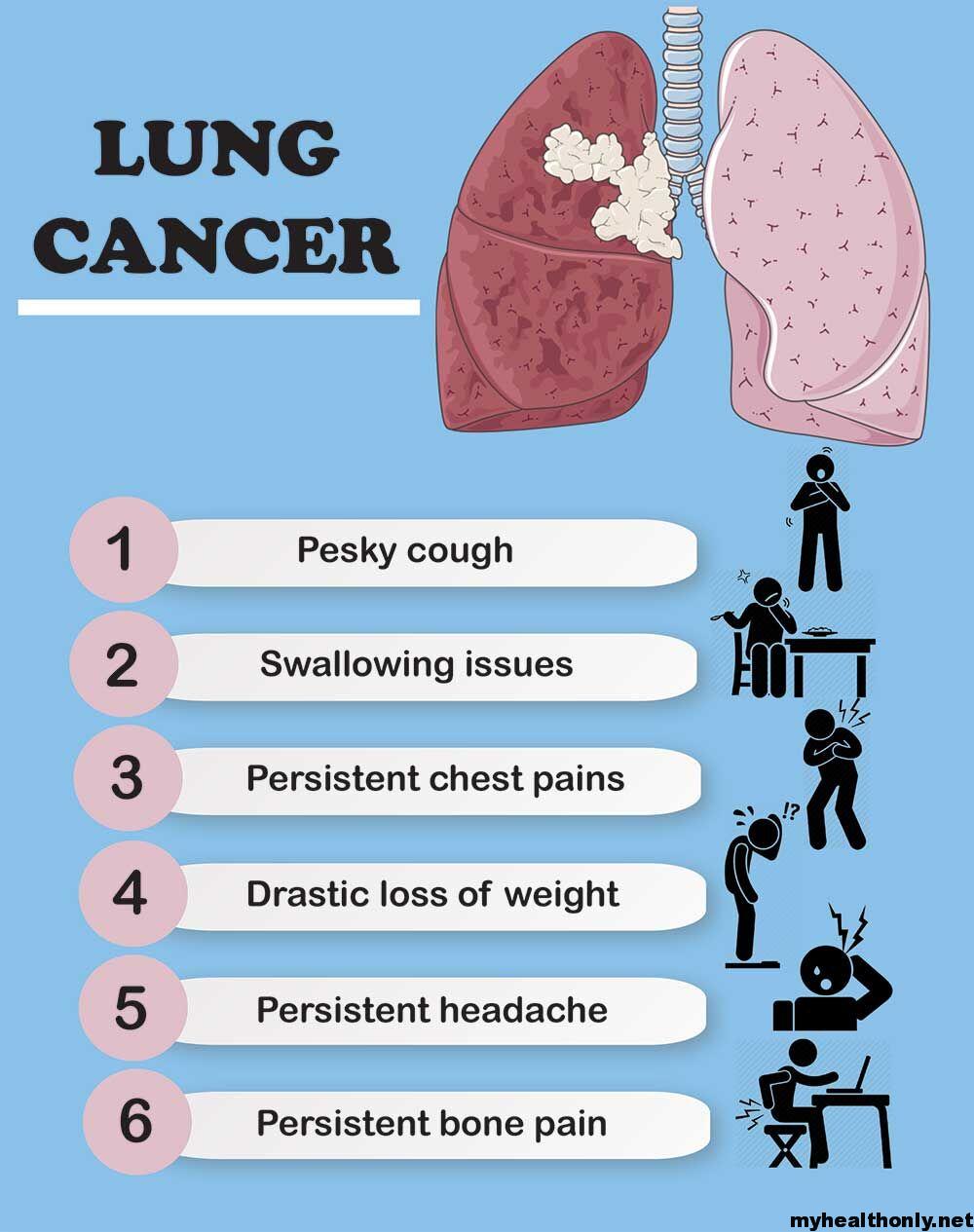Symptoms of Lung Cancer, Causes, Signs &  Risk Factors