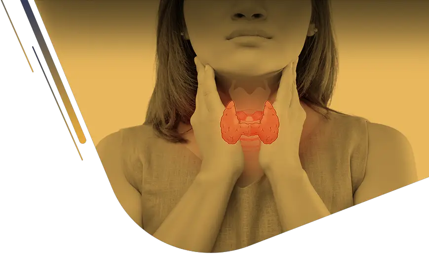 Thyroid Overview: Its Types, Causes, Diagnosis, Symptoms ...
