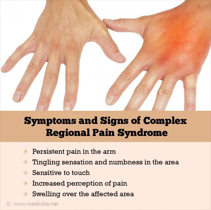 Types and Symptoms of Complex Regional Pain Syndrome