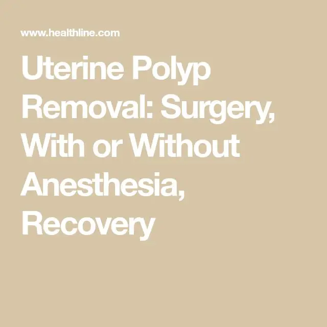Uterine Polyp Removal: Surgery, With or Without Anesthesia, Recovery ...
