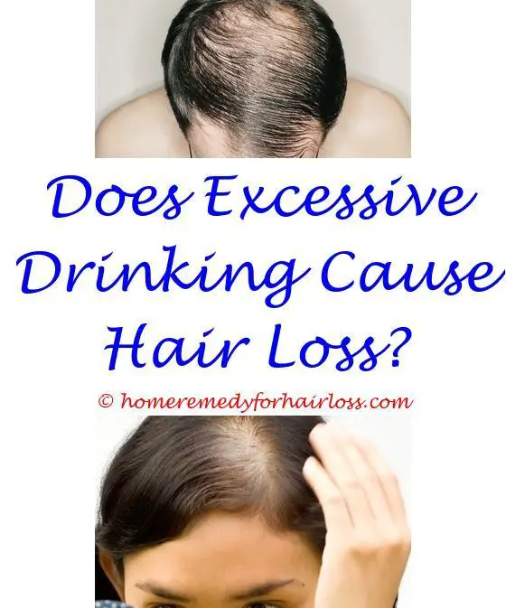 Weight Loss Leads To Hair Loss