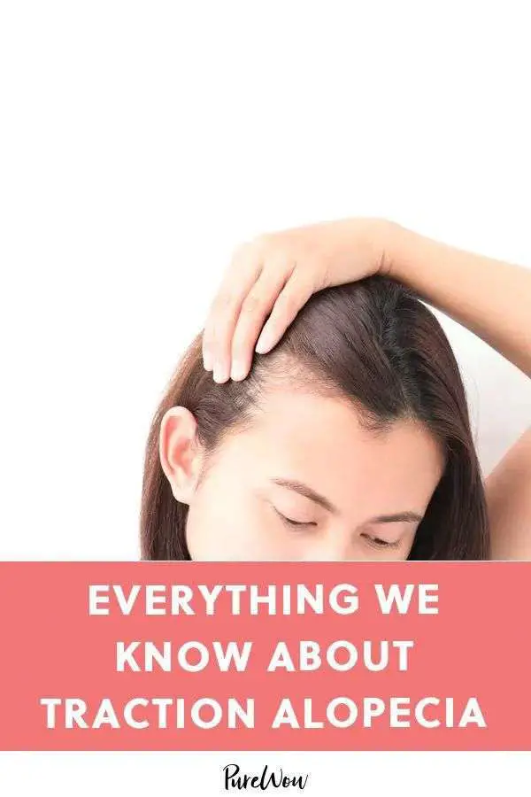 What Causes Traction Alopecia? And How Do You Treat It? # ...