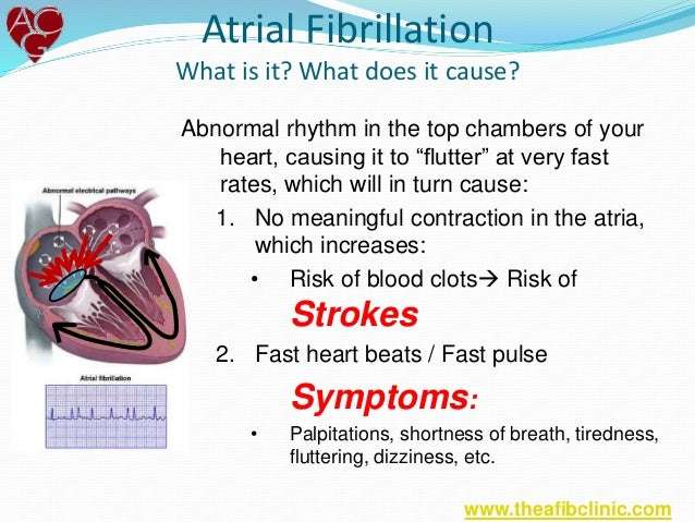 What is Atrial Fibrillation (afib)?